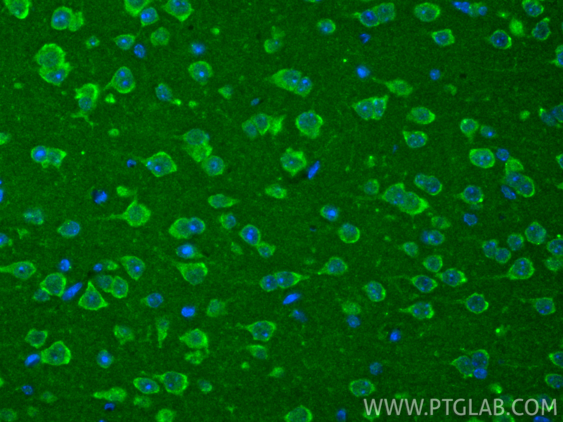 IF Staining of mouse brain using 18255-1-AP