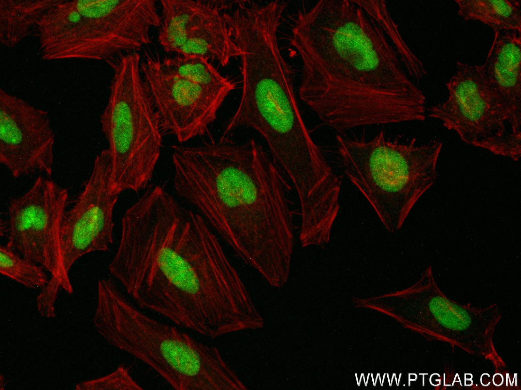 IF Staining of HeLa using 83843-5-RR