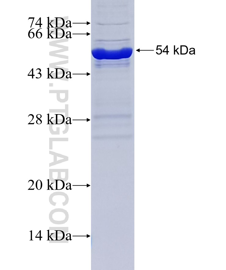 TRMT61A fusion protein Ag34396 SDS-PAGE