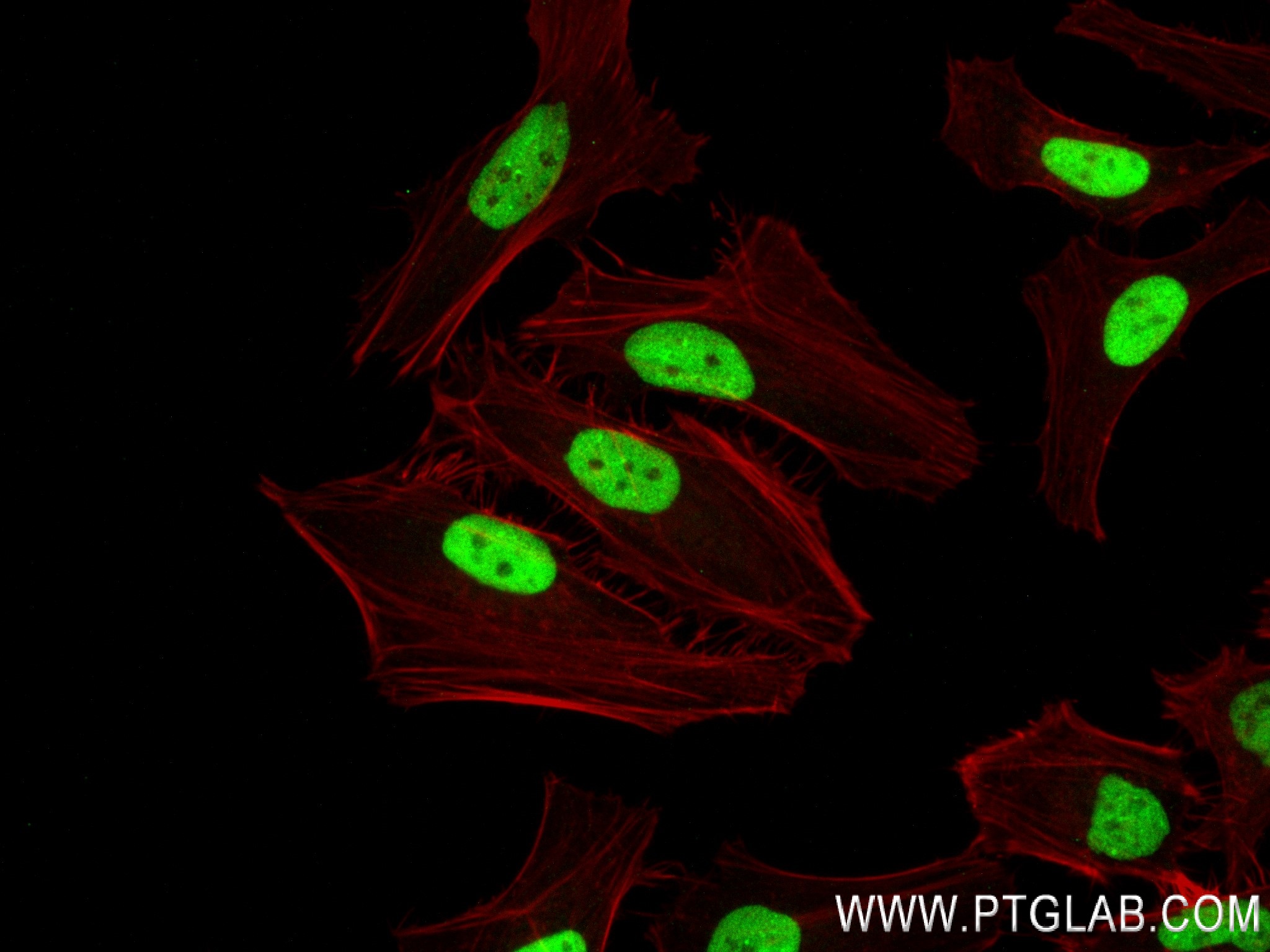 IF Staining of HeLa using 83410-4-RR