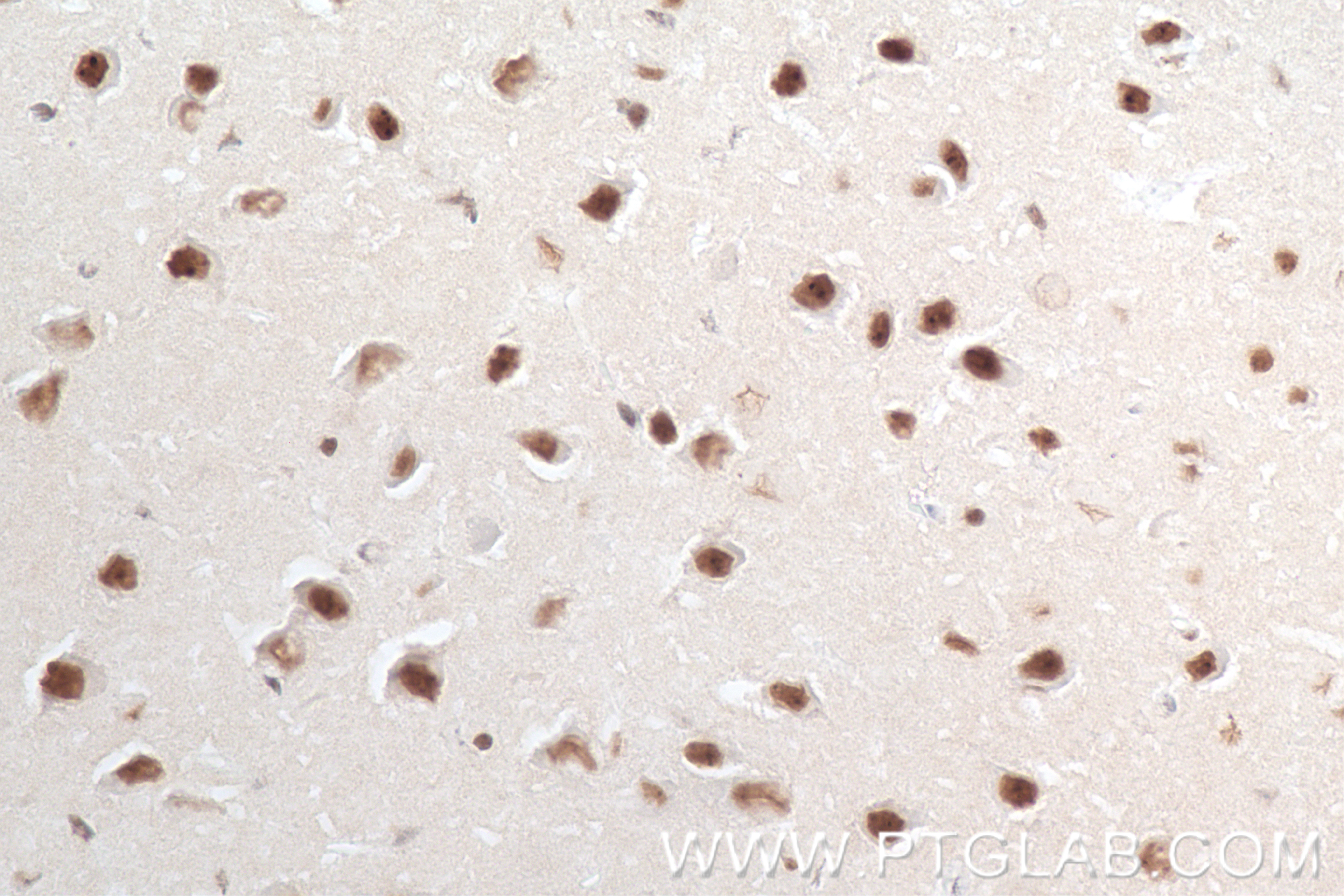 IHC staining of mouse brain using 83410-4-RR