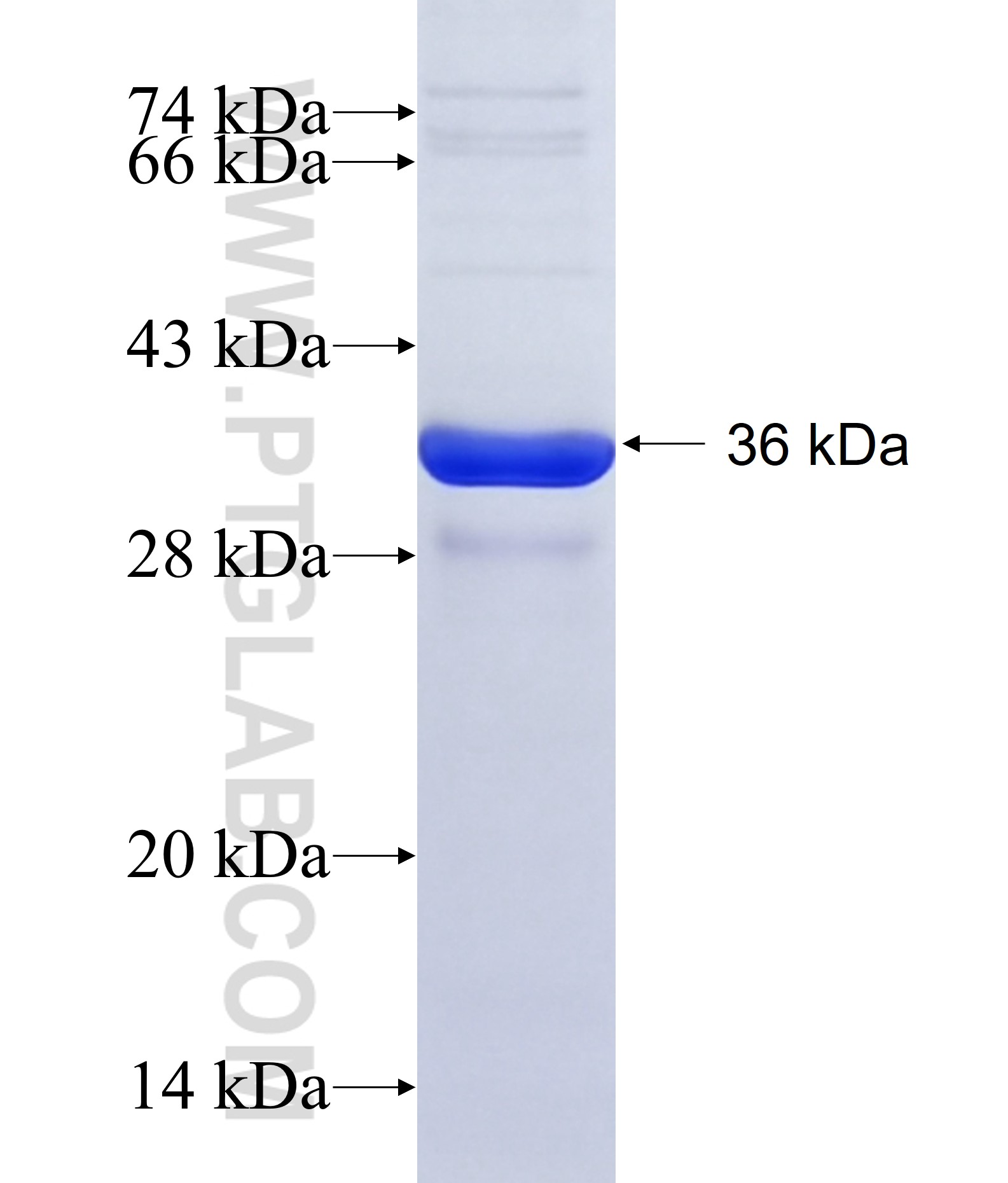 TRNP1 fusion protein Ag22876 SDS-PAGE TRNP1 fusion protein Ag22876 SDS-PAGE