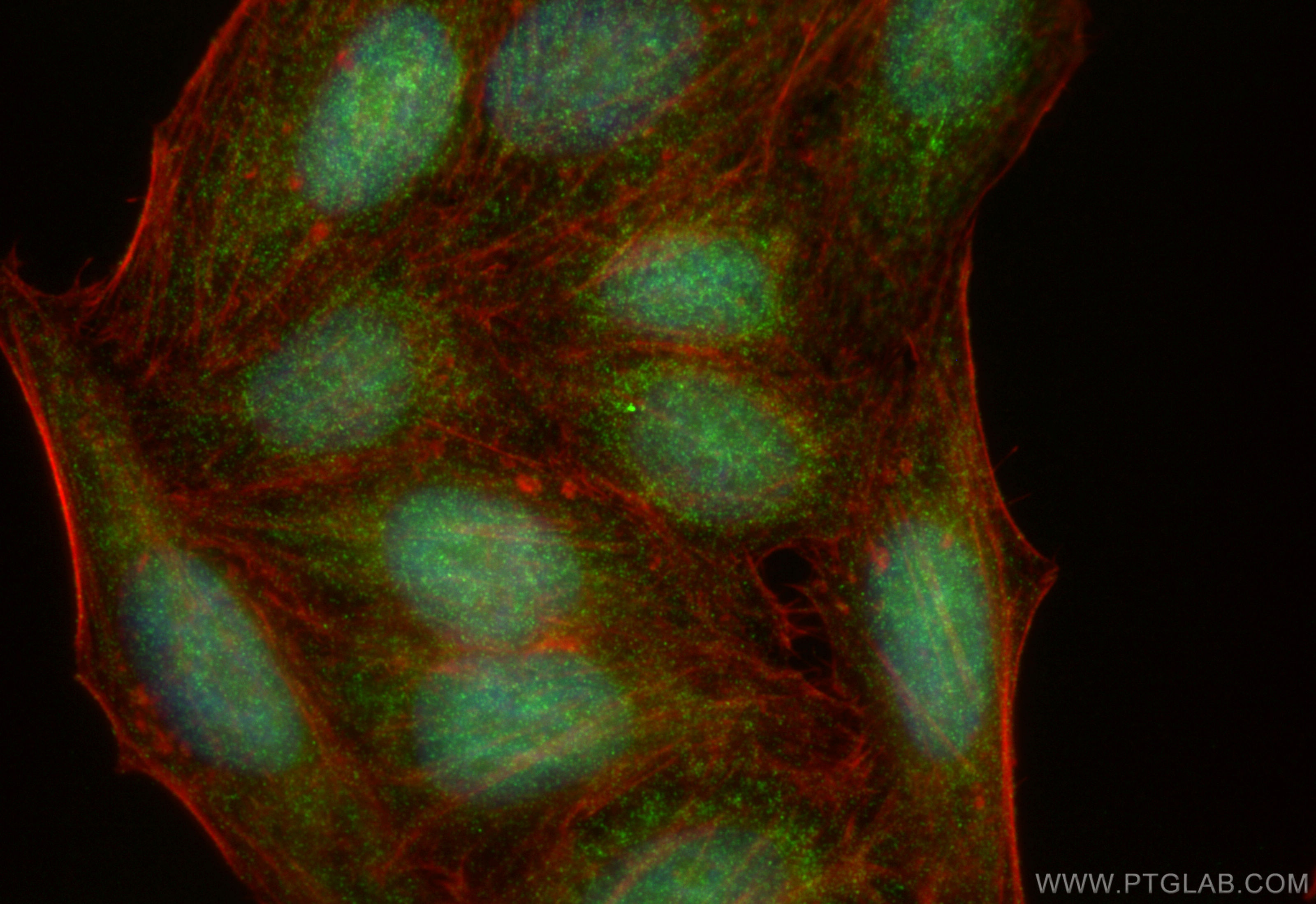 IF Staining of HepG2 using 31906-1-AP