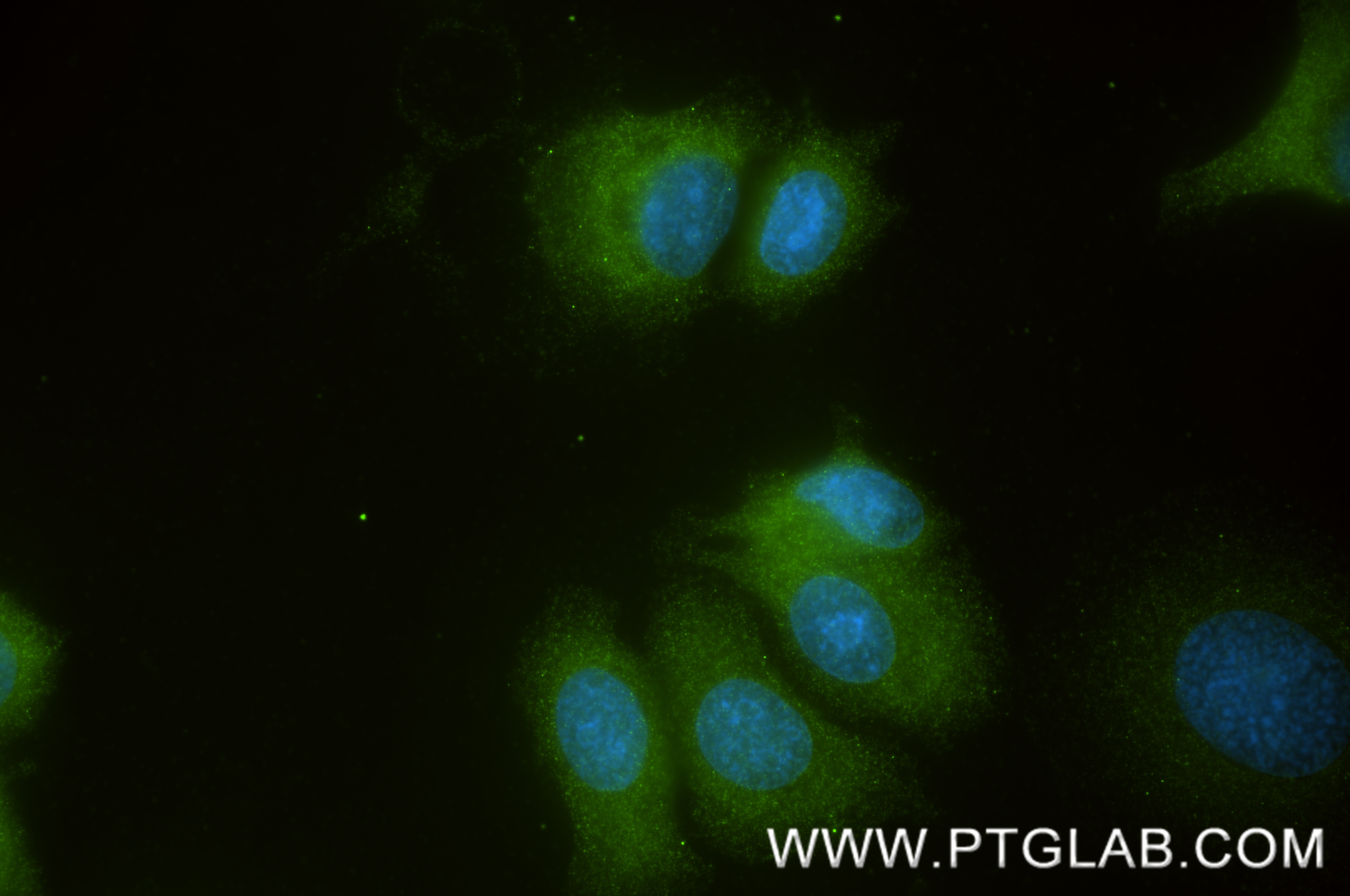 IF Staining of SK-BR-3 using 86735-2-RR (same clone as 86735-2-PBS) IF Staining of SK-BR-3 using 86735-2-RR (same clone as 86735-2-PBS)