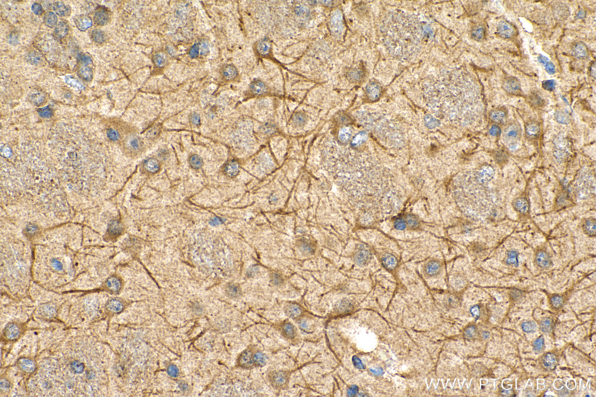 IHC staining of mouse brain using 67149-1-Ig