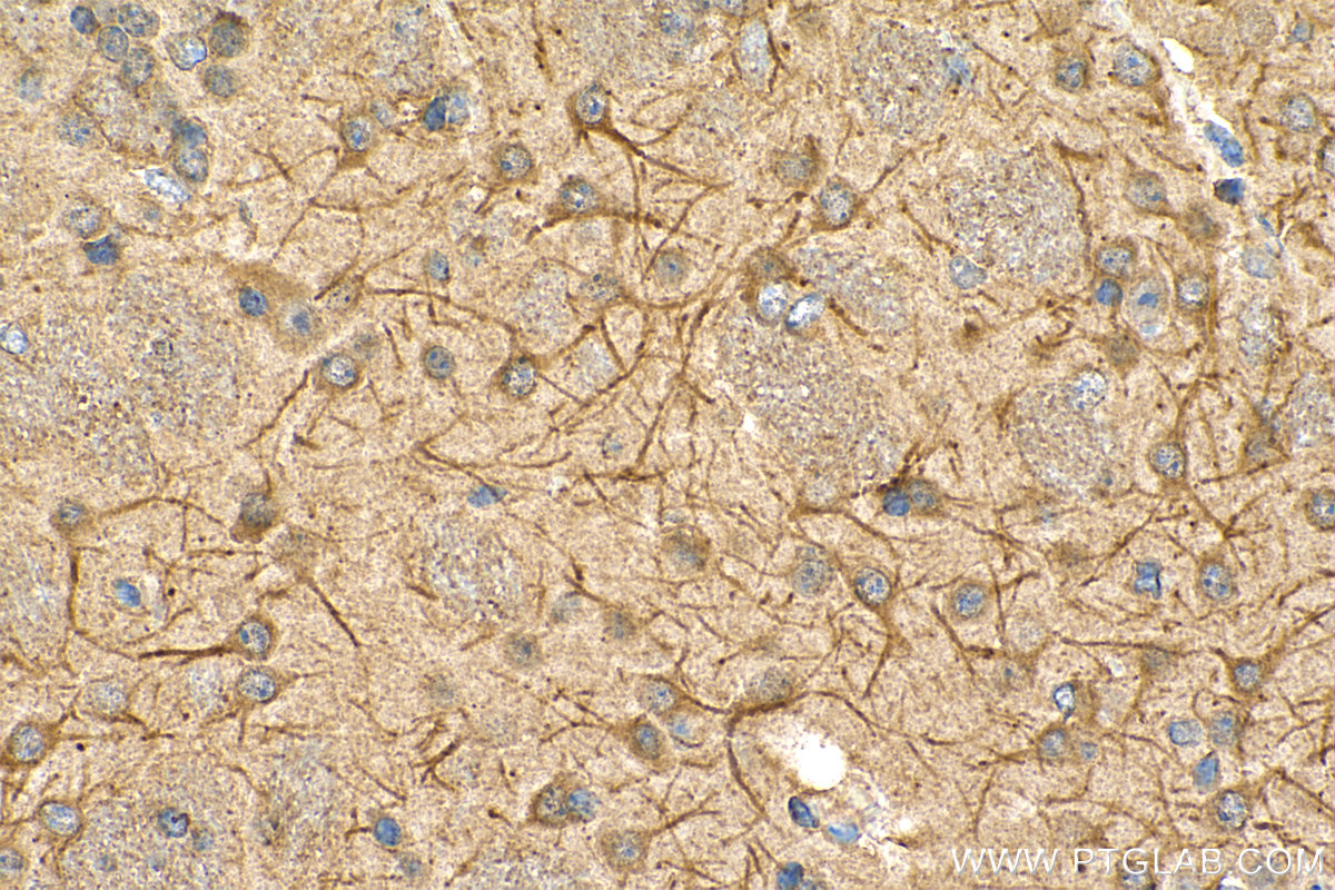 IHC staining of mouse brain using 67149-1-Ig (same clone as 67149-1-PBS)