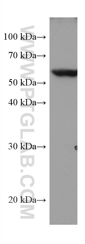 WB analysis of HeLa using 67149-1-Ig (same clone as 67149-1-PBS)