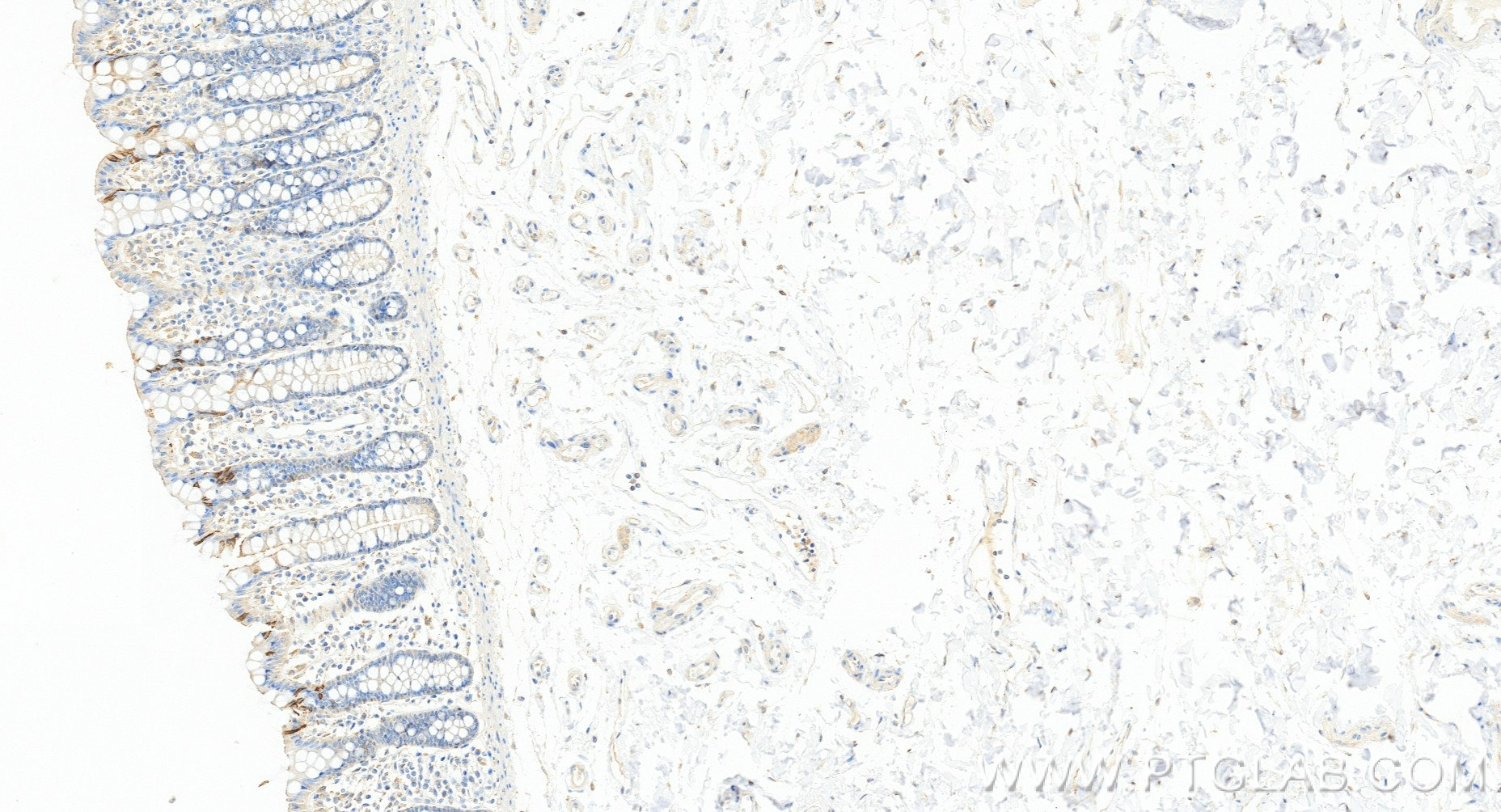 IHC staining of human colon using 84986-3-RR (same clone as 84986-3-PBS)