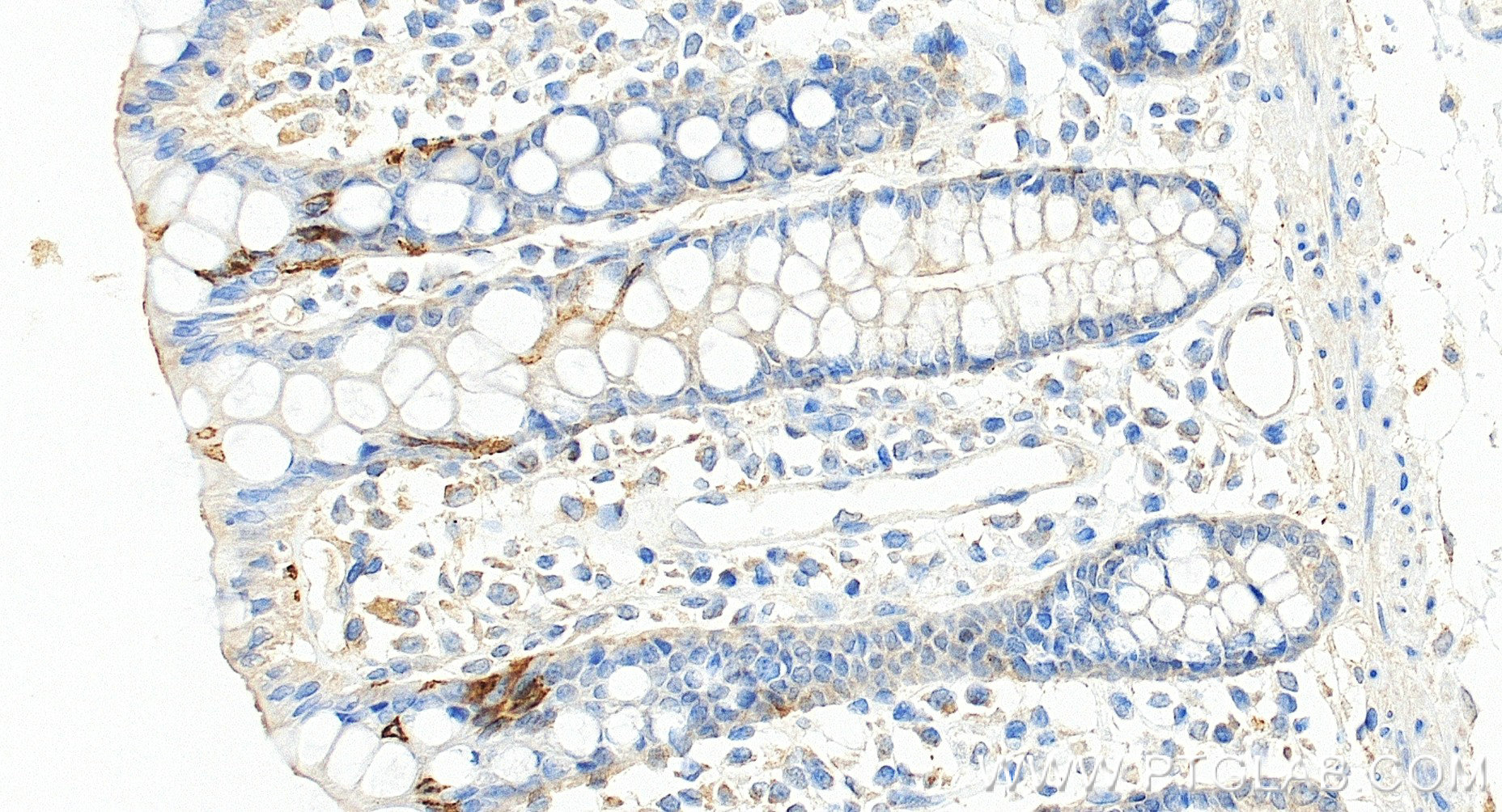IHC staining of human colon using 84986-3-RR (same clone as 84986-3-PBS)
