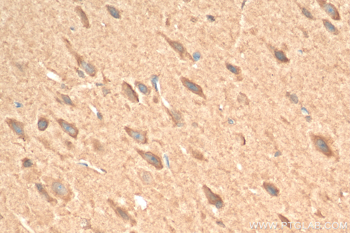 IHC staining of rat brain using 24727-1-AP