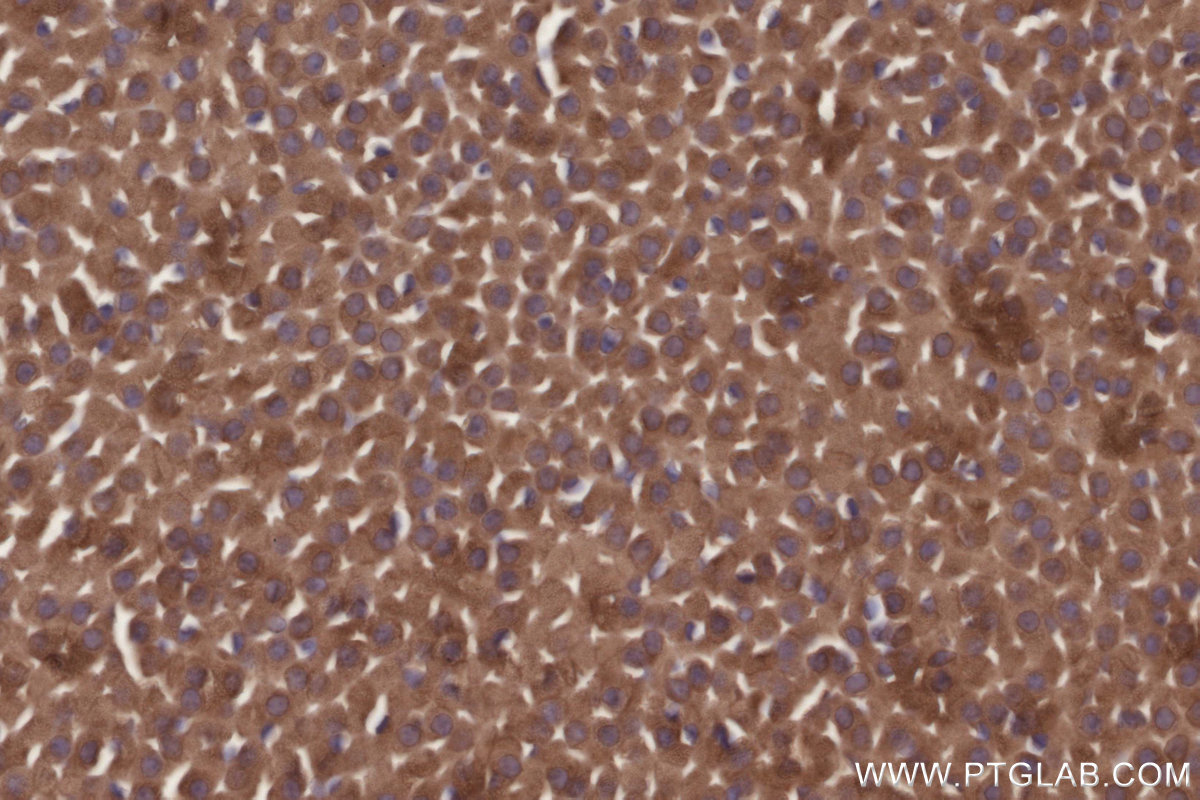 IHC staining of mouse adrenal gland using 29310-1-AP