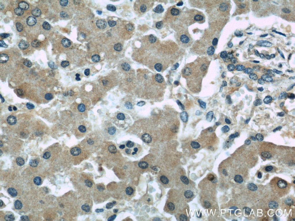 IHC staining of human liver using 66138-1-Ig (same clone as 66138-1-PBS)