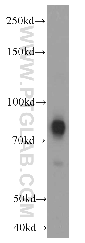 WB analysis of human brain using 66138-1-Ig (same clone as 66138-1-PBS)