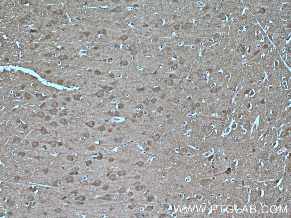 IHC staining of human brain using 25890-1-AP