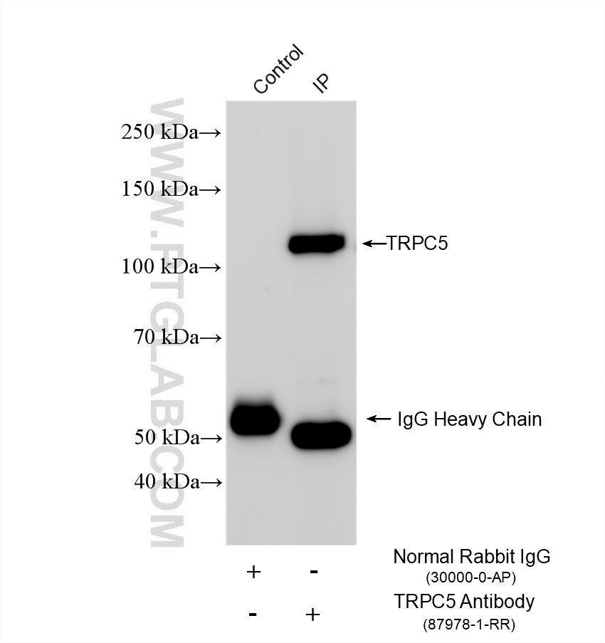 IP experiment of rat brain using 87978-1-RR (same clone as 87978-1-PBS) IP experiment of rat brain using 87978-1-RR (same clone as 87978-1-PBS)
