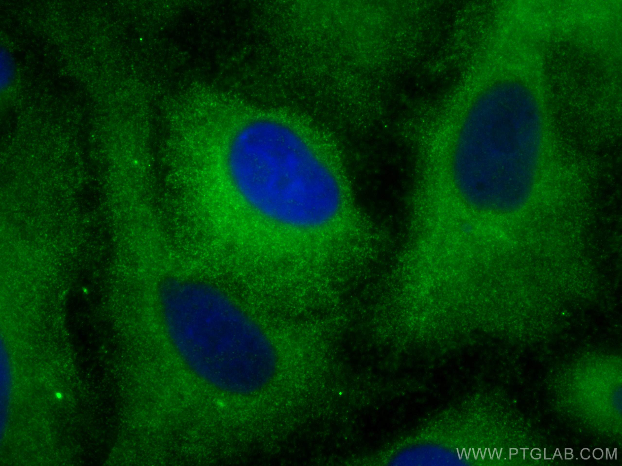 IF Staining of A549 using 18236-1-AP