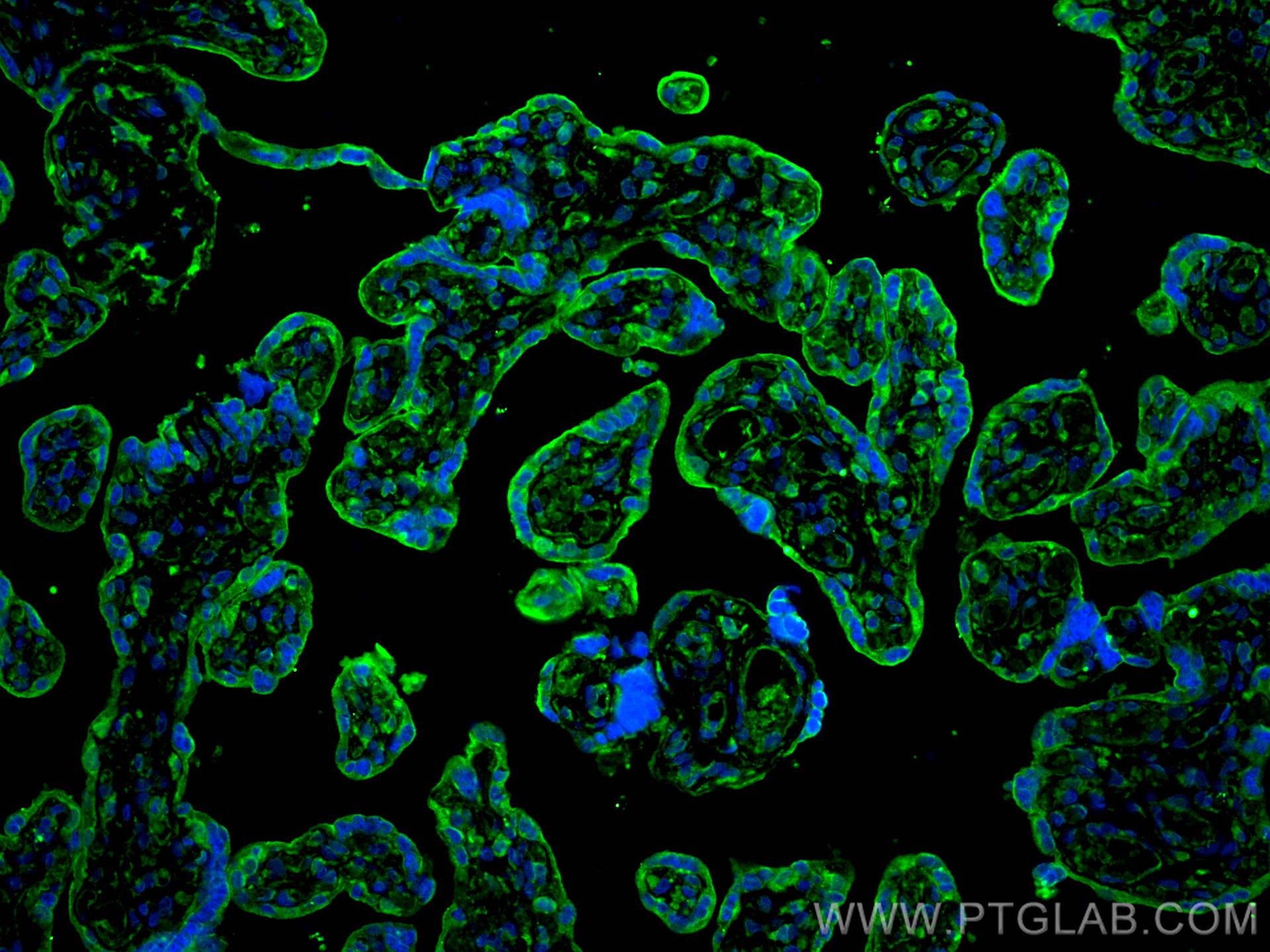 IF Staining of human placenta using 18236-1-AP