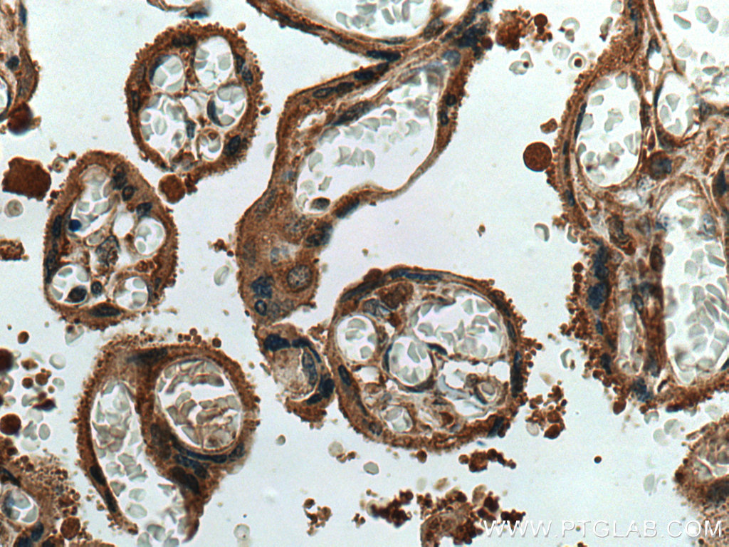 IHC staining of human placenta using 18236-1-AP