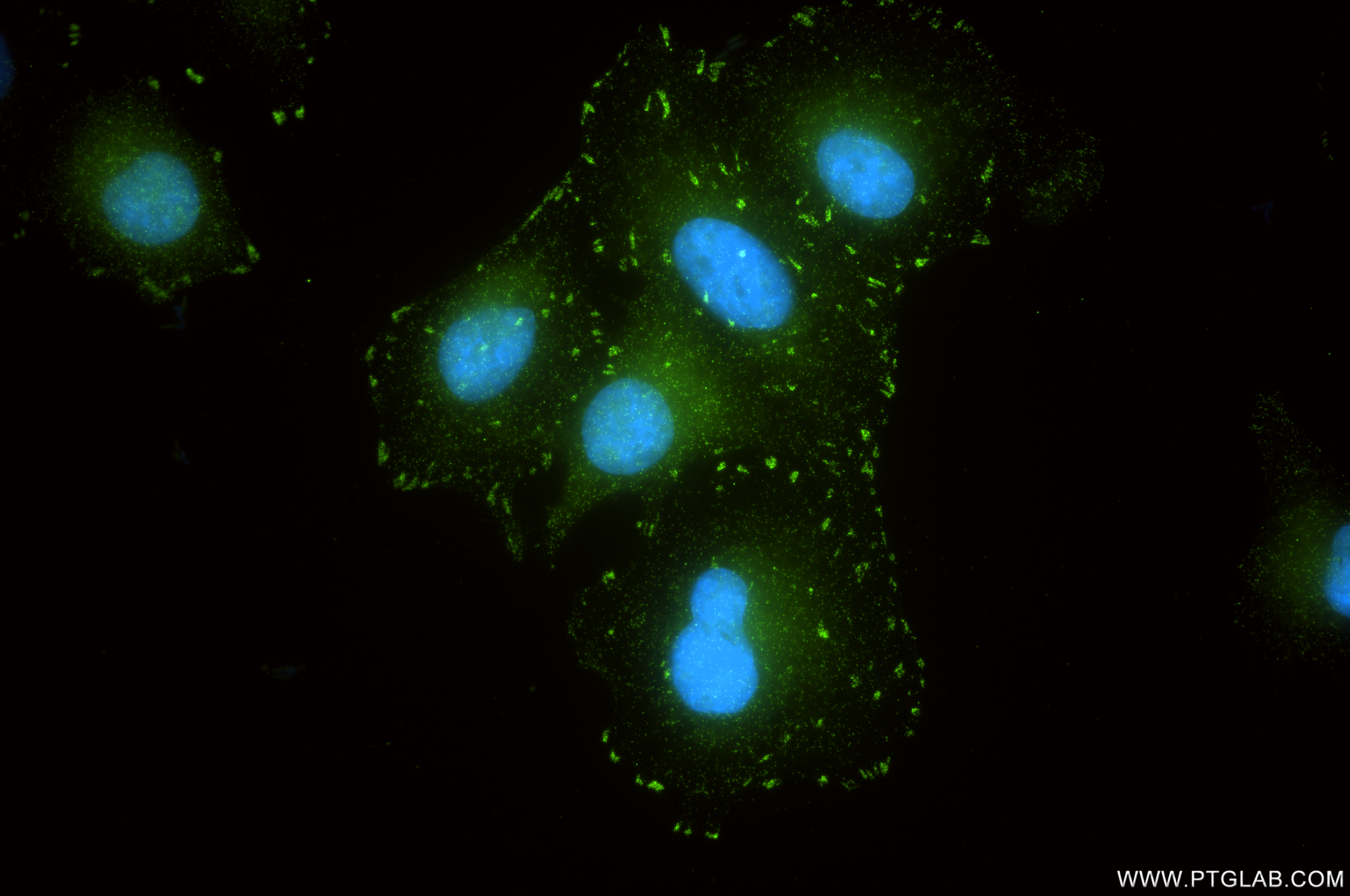 IF Staining of A549 using 84517-5-RR IF Staining of A549 using 84517-5-RR