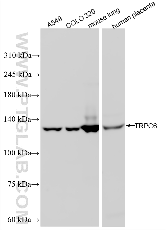 WB analysis using 84517-5-RR WB analysis using 84517-5-RR
