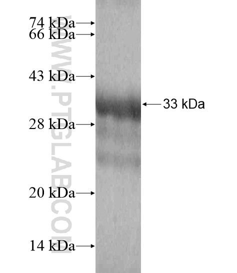 TRPC7 fusion protein Ag19075 SDS-PAGE TRPC7 fusion protein Ag19075 SDS-PAGE