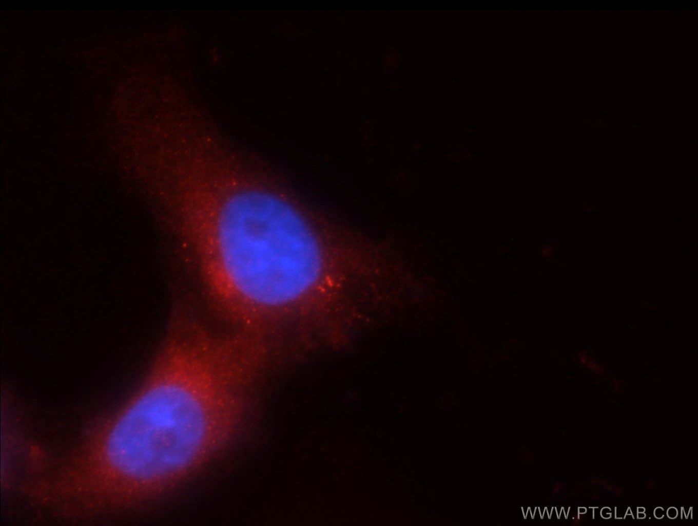 IF Staining of SH-SY5Y using 55111-1-AP