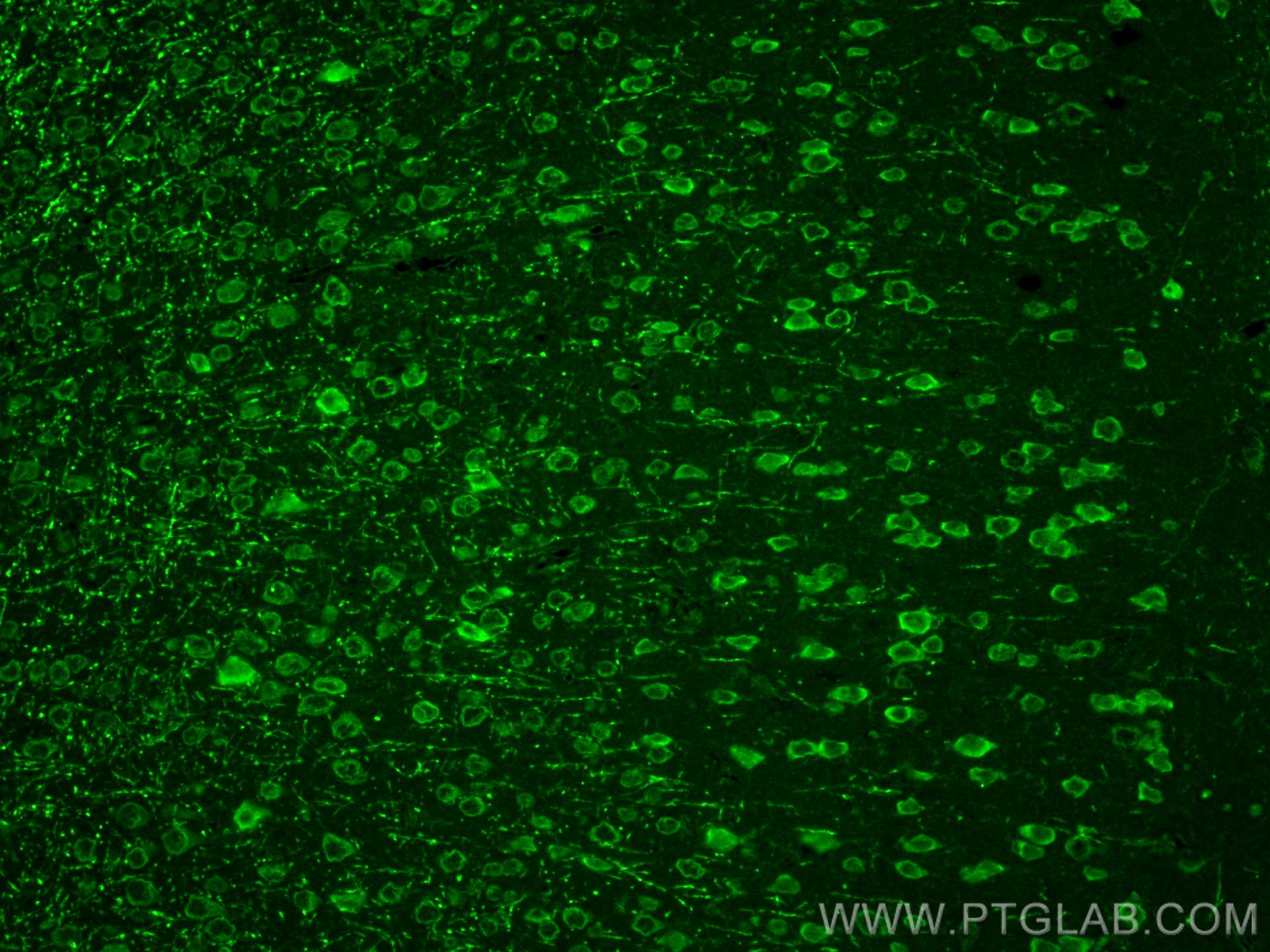 IF Staining of mouse brain using 21842-1-AP