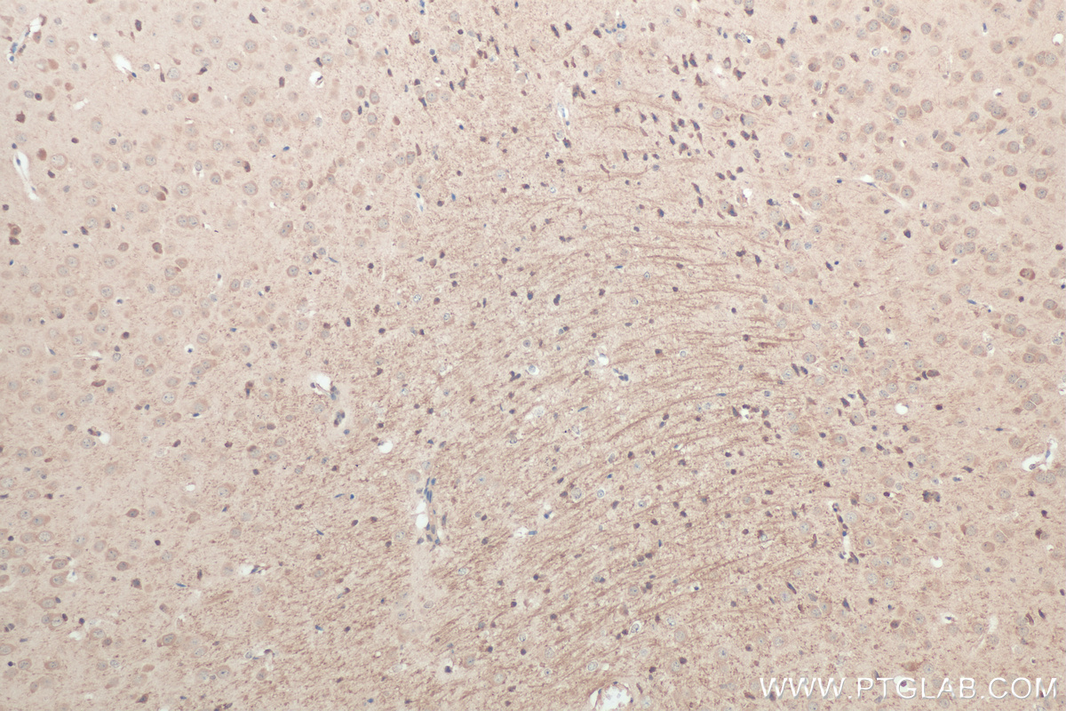 IHC staining of mouse brain using 21842-1-AP
