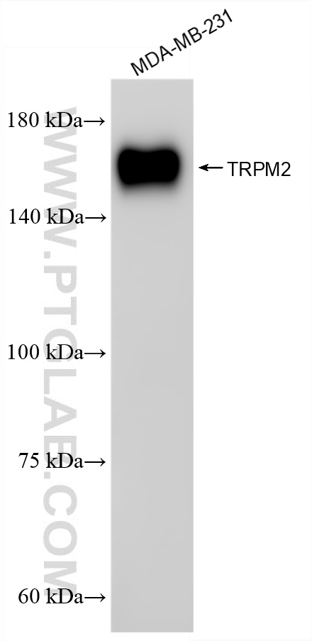 MDA-MB-231 cells were subjected to SDS PAGE followed by western blot with <a class='green' href='/productredirect?CatalogNo=87036-1-RR' target='_blank'>87036-1-RR</a> (TRPM2 antibody) at dilution of 1:5000 incubated at room temperature for 1.5 hours. This data was developed using the same antibody clone with 87036-1-PBS in a different storage buffer formulation. WB analysis of MDA-MB-231 using 87036-1-RR (same clone as 87036-1-PBS)
