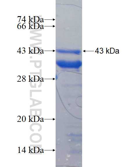 TRPM2 fusion protein Ag17172 SDS-PAGE TRPM2 fusion protein Ag17172 SDS-PAGE
