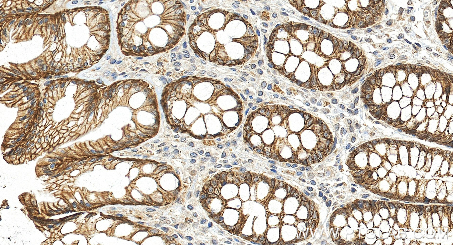 IHC staining of human colon using 87085-1-RR (same clone as 87085-1-PBS)