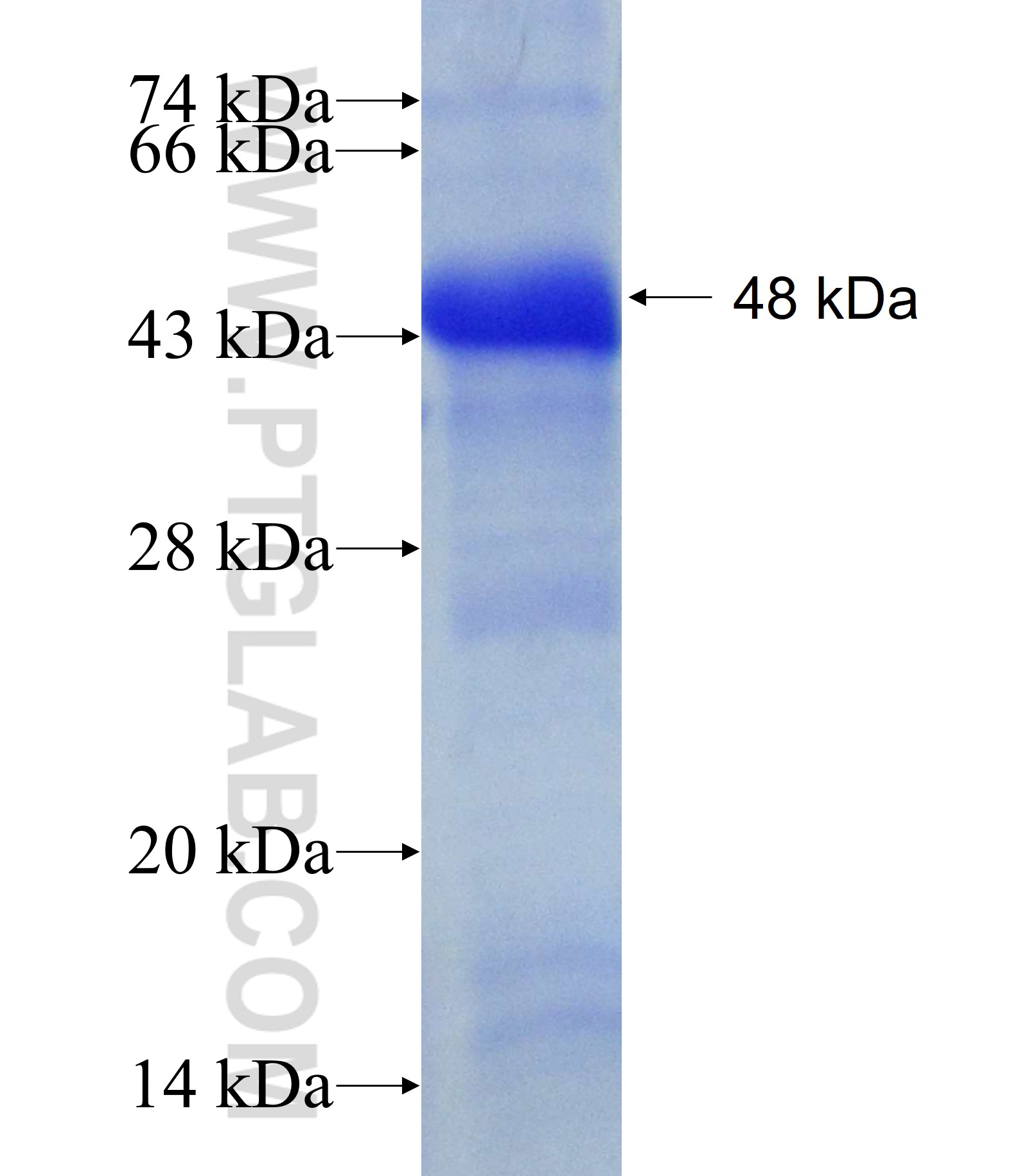 TRPM4 fusion protein Ag17687 SDS-PAGE