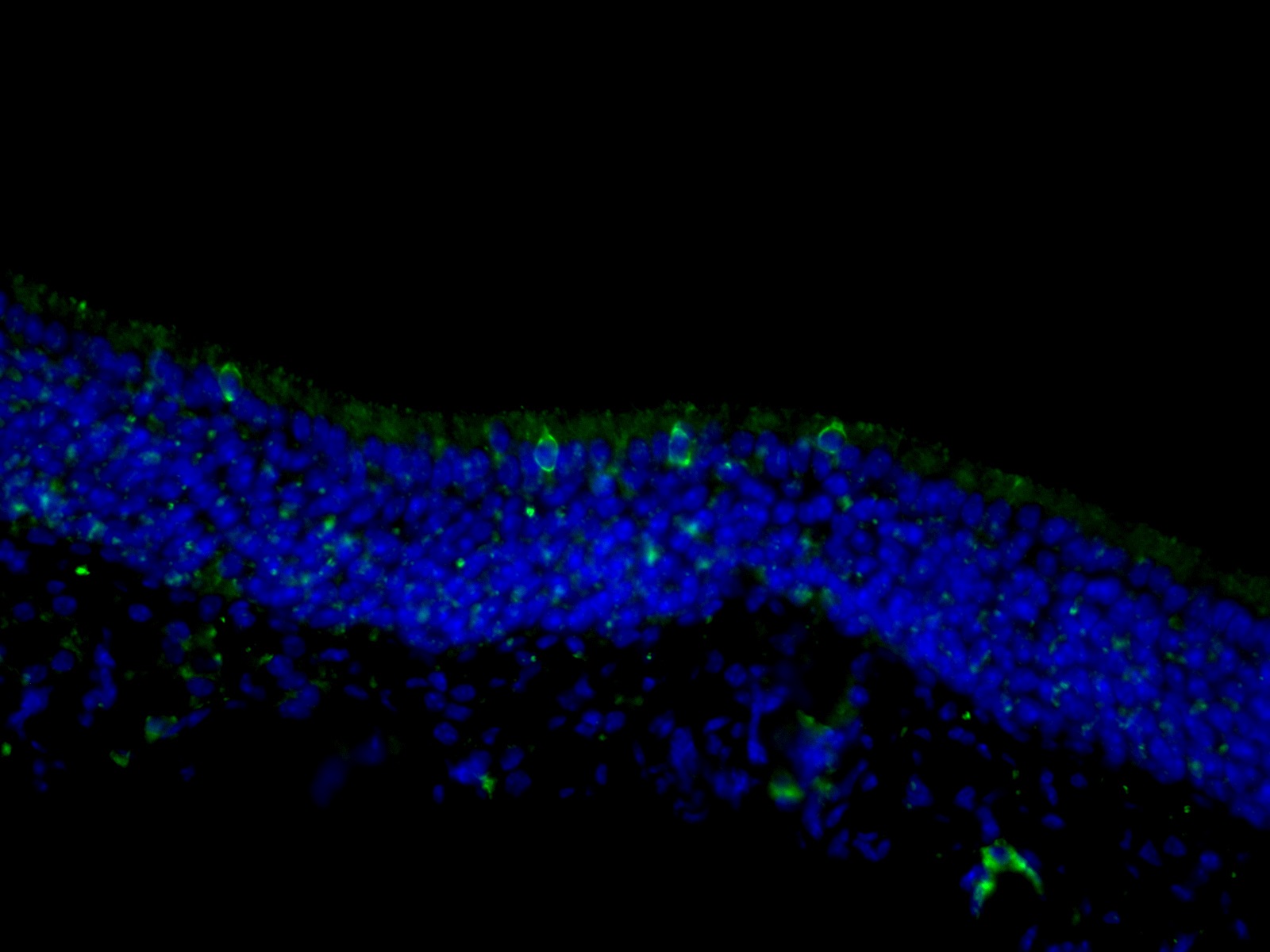 IF Staining of mouse olfactory epithelium tissue using 18027-1-AP