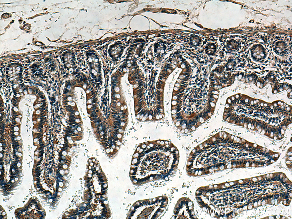 IHC staining of human small intestine using 18027-1-AP