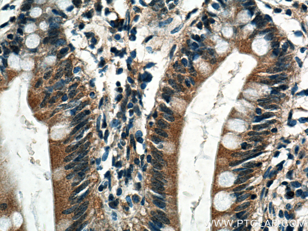 IHC staining of human small intestine using 18027-1-AP