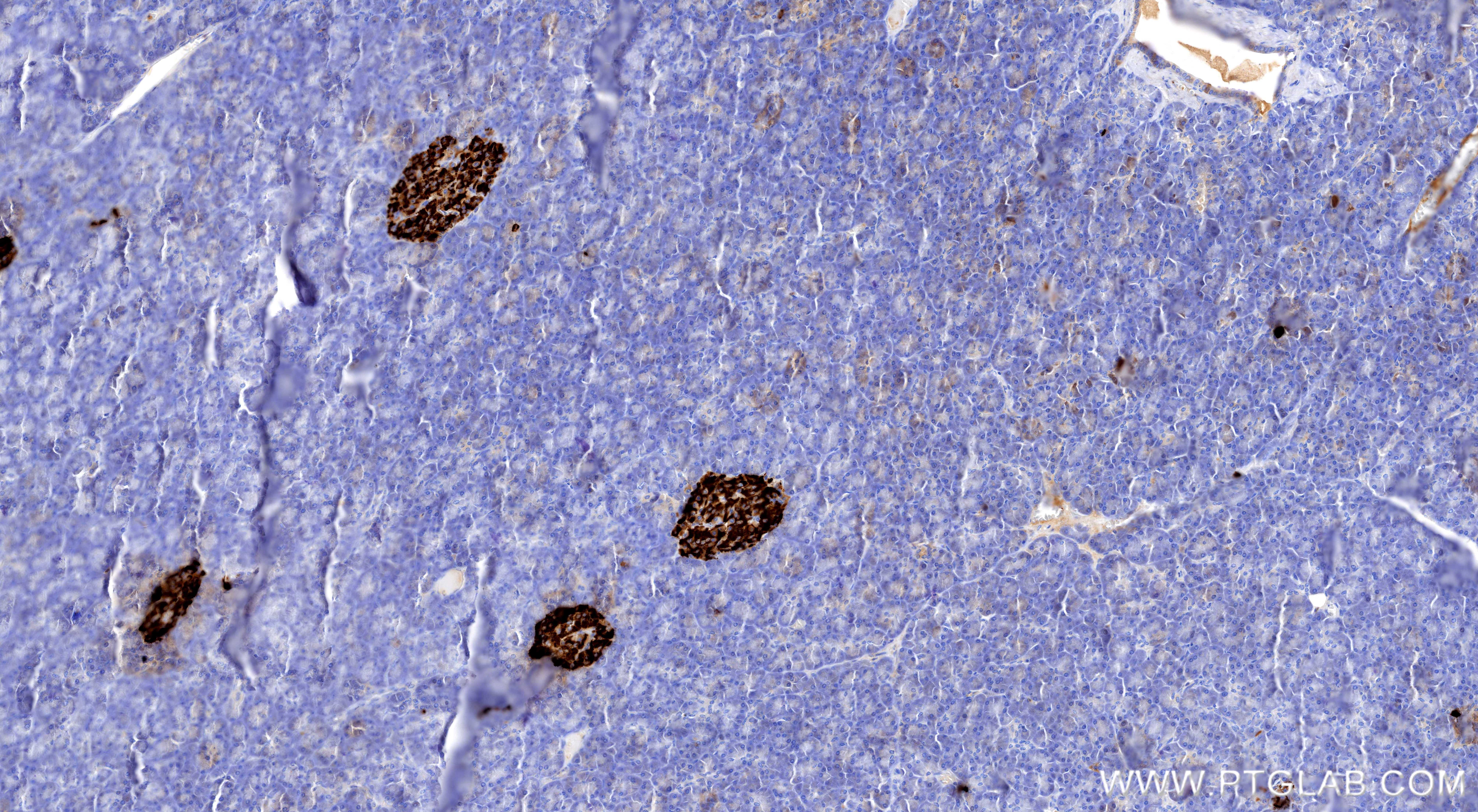 IHC staining of human pancreas using 98691-2-RR (same clone as 98691-2-PBS)