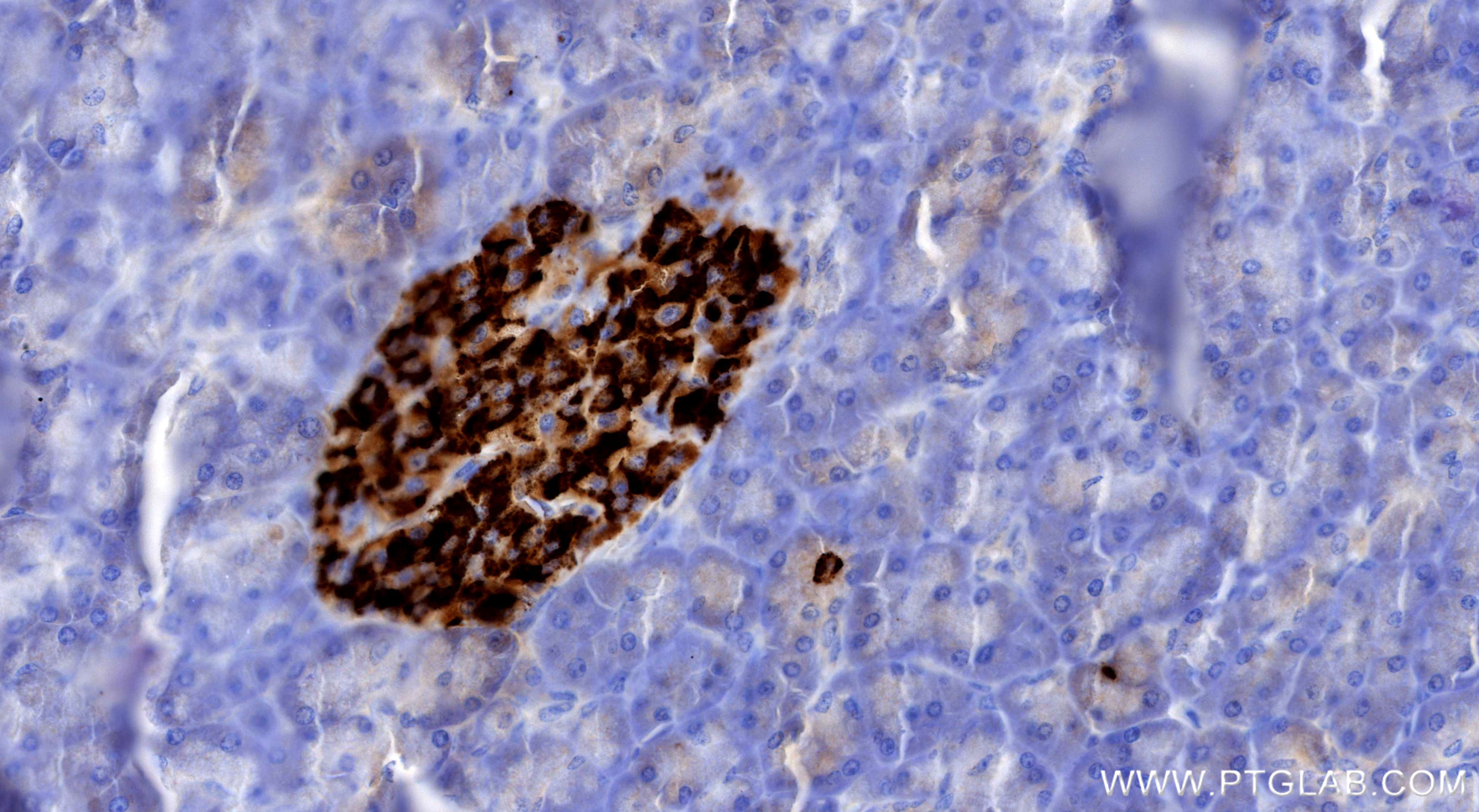IHC staining of human pancreas using 98691-2-RR (same clone as 98691-2-PBS)