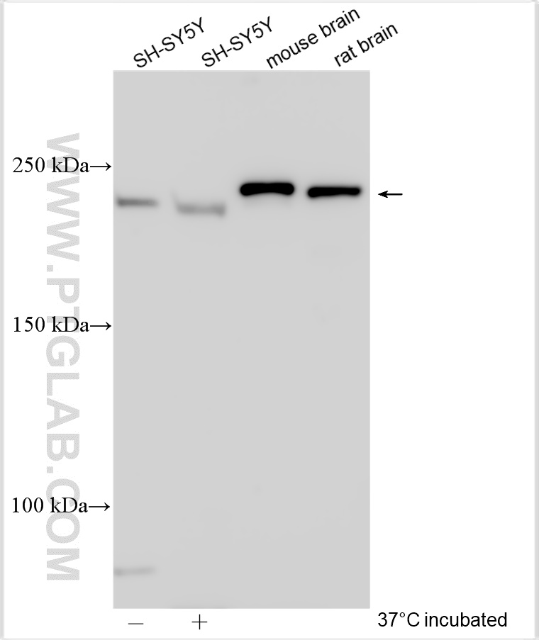 WB analysis using 55251-1-AP