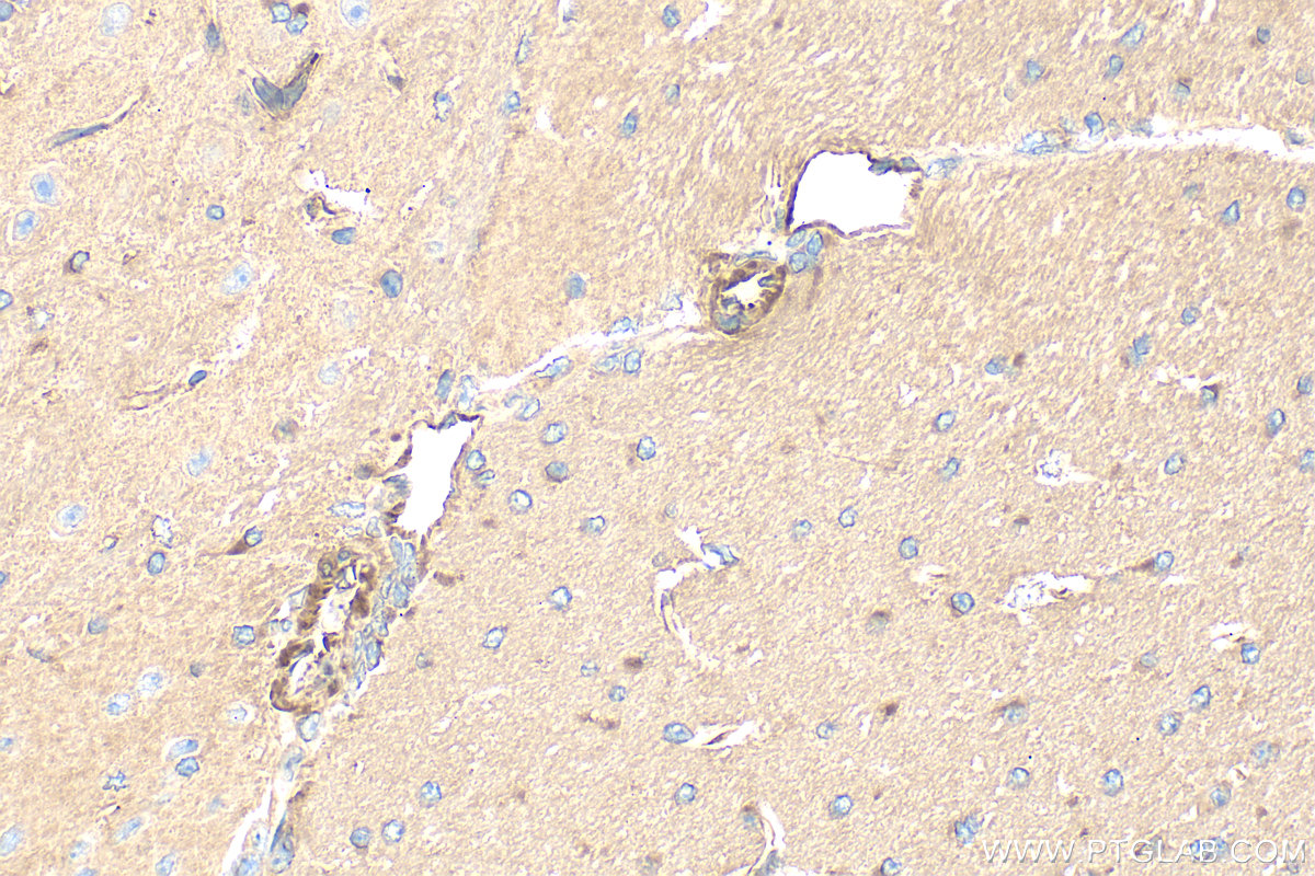 IHC staining of mouse brain using 84324-1-RR