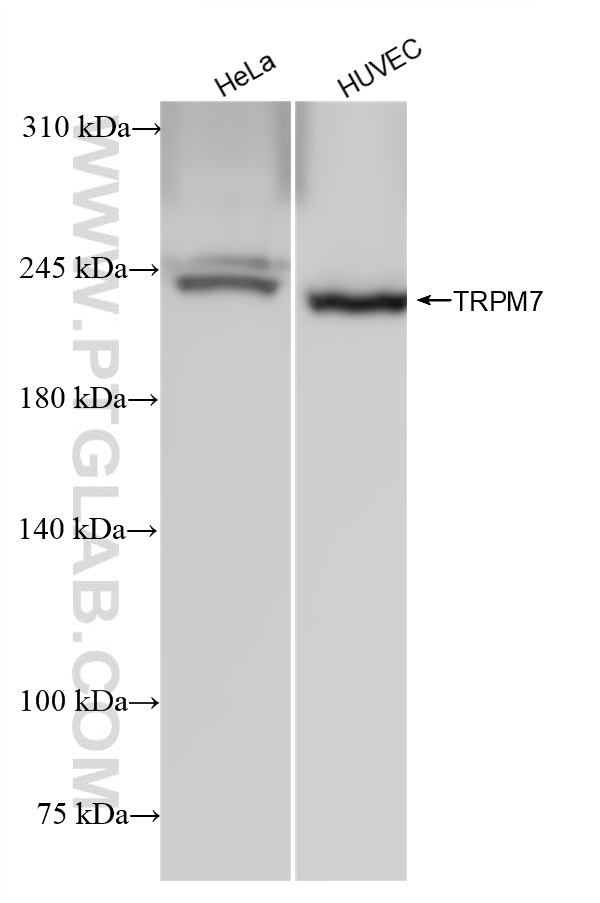 WB analysis using 84324-1-RR (same clone as 84324-1-PBS)