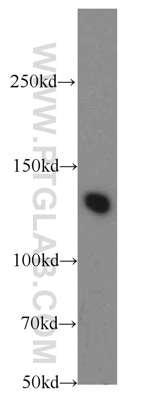 WB analysis of mouse brain using 20003-1-AP