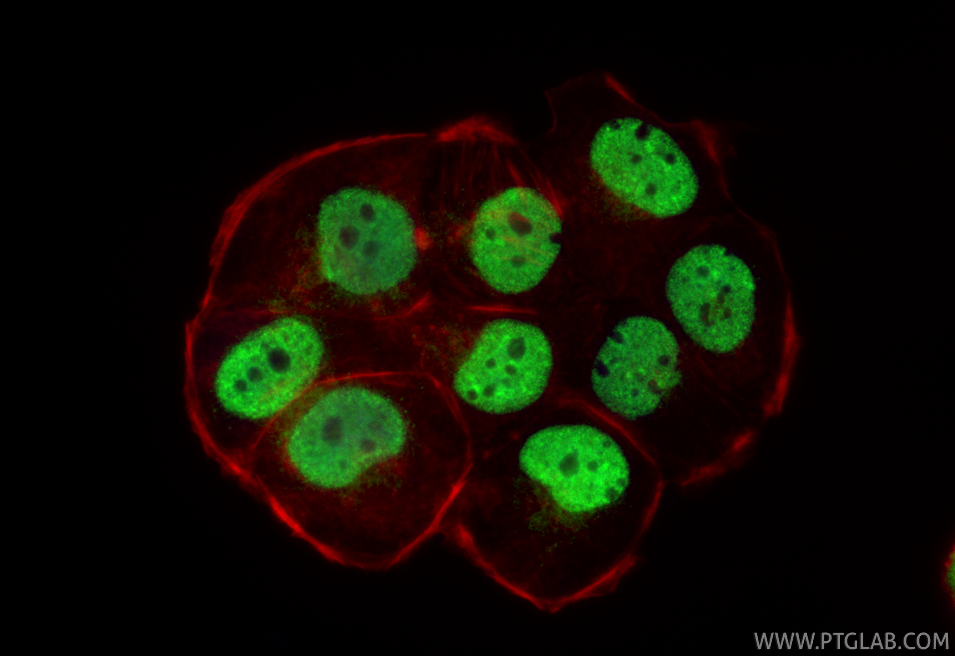 IF Staining of T-47D using 21938-1-AP IF Staining of T-47D using 21938-1-AP