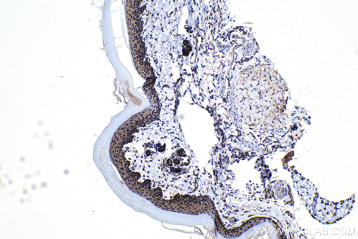 IHC staining of mouse skin using 21938-1-AP IHC staining of mouse skin using 21938-1-AP