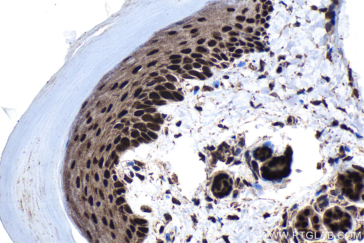 IHC staining of mouse skin using 21938-1-AP IHC staining of mouse skin using 21938-1-AP