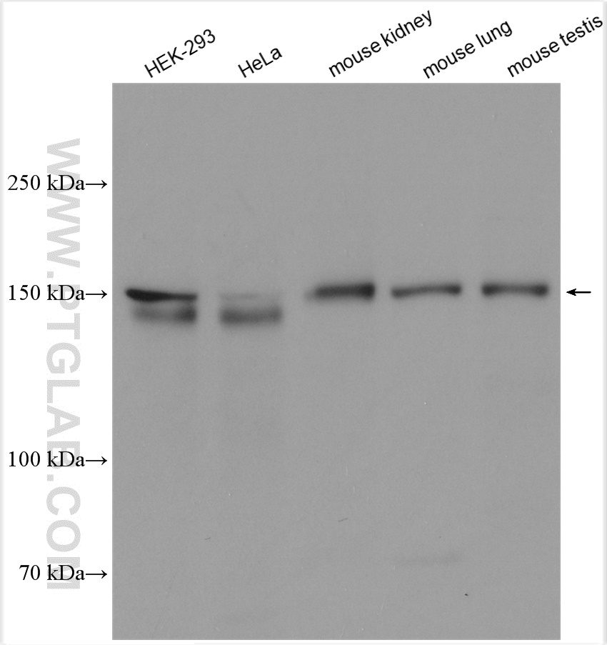 WB analysis using 21938-1-AP