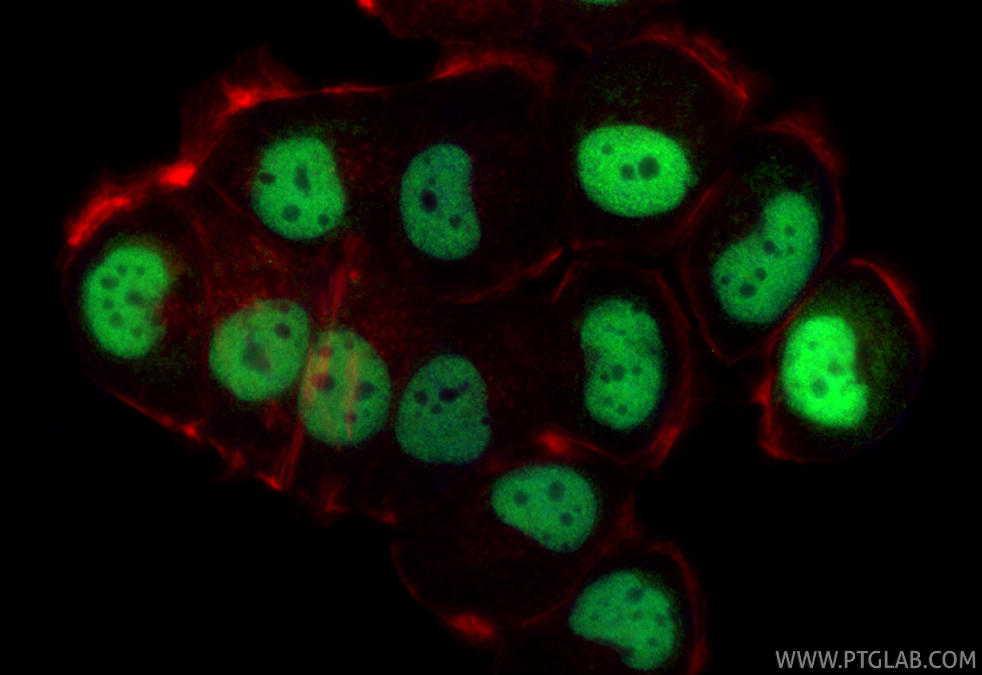IF Staining of T-47D using 28753-1-AP