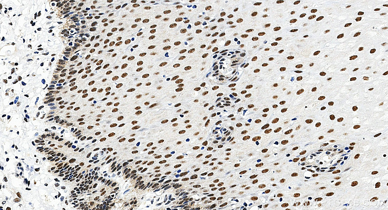 IHC staining of human oesophagus using 28753-1-AP
