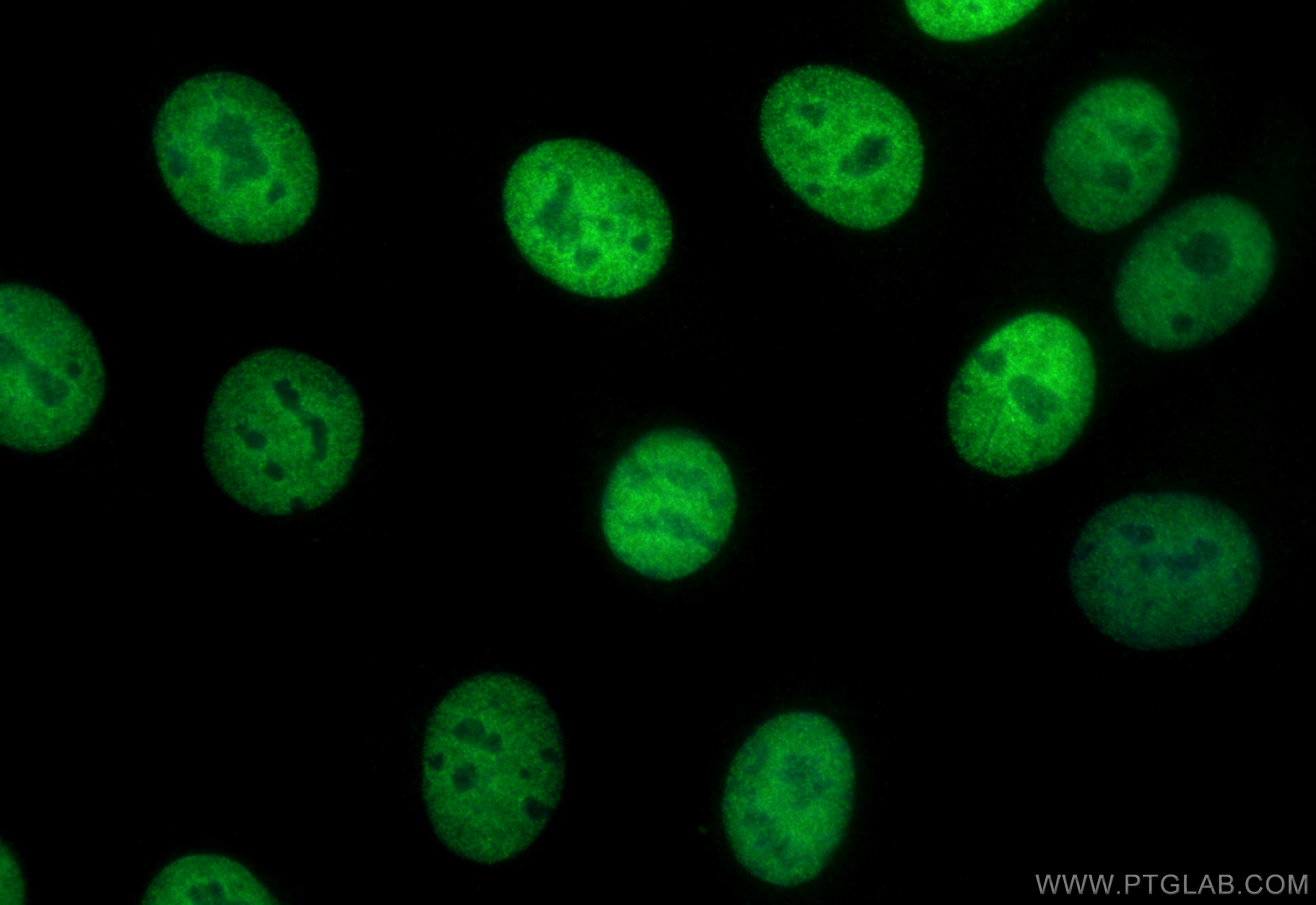 IF Staining of MCF-7 using CL488-21938