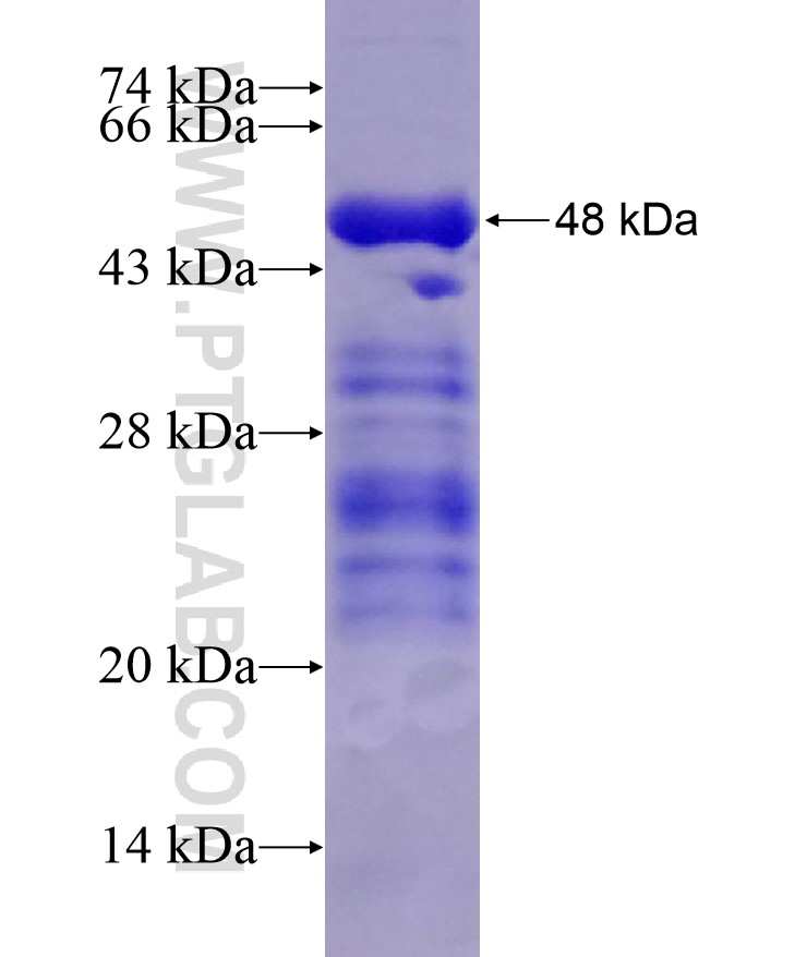 TRPV1 fusion protein Ag18583 SDS-PAGE