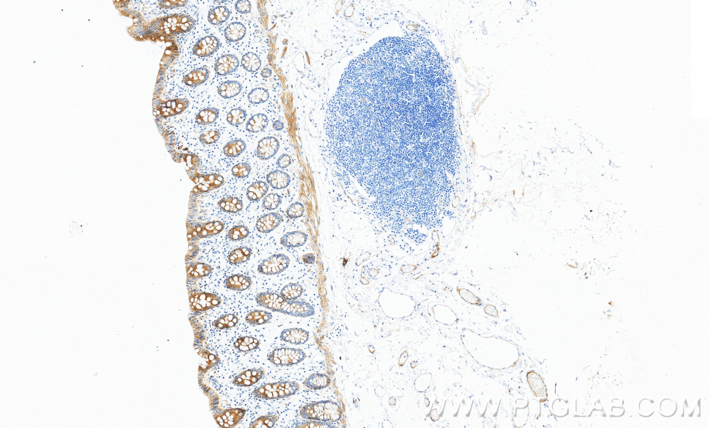 IHC staining of human colon using 98690-1-RR